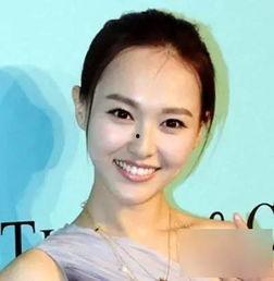 额头突出的明星,揭秘额头突出者的独特魅力