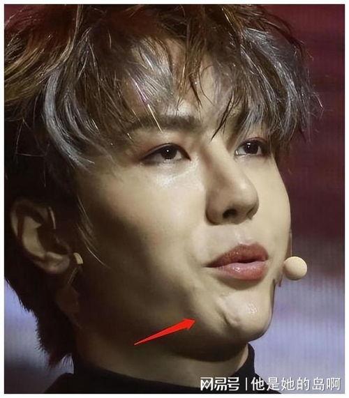 男明星头部流血,男星头部意外受伤，英勇无畏的瞬间
